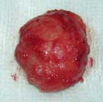 Cyst that was removed from the leg of an English Bulldog
